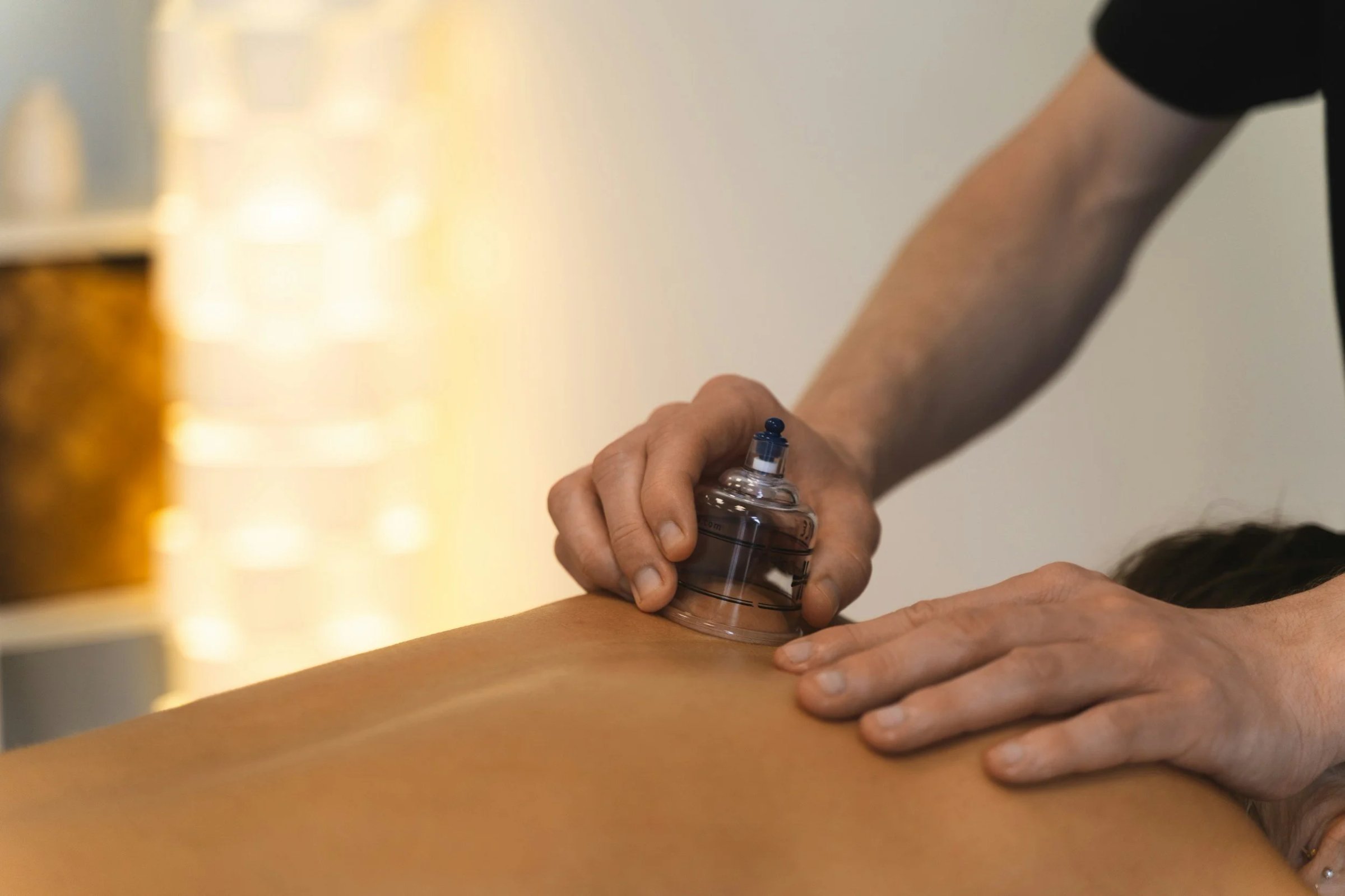A person receiving cupping therapy on their back from a practitioner.